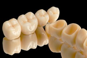 Ne éljen együtt fogproblémáival!