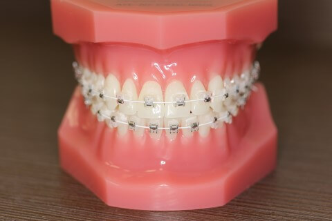 Ön rendszeresen mos fogat?