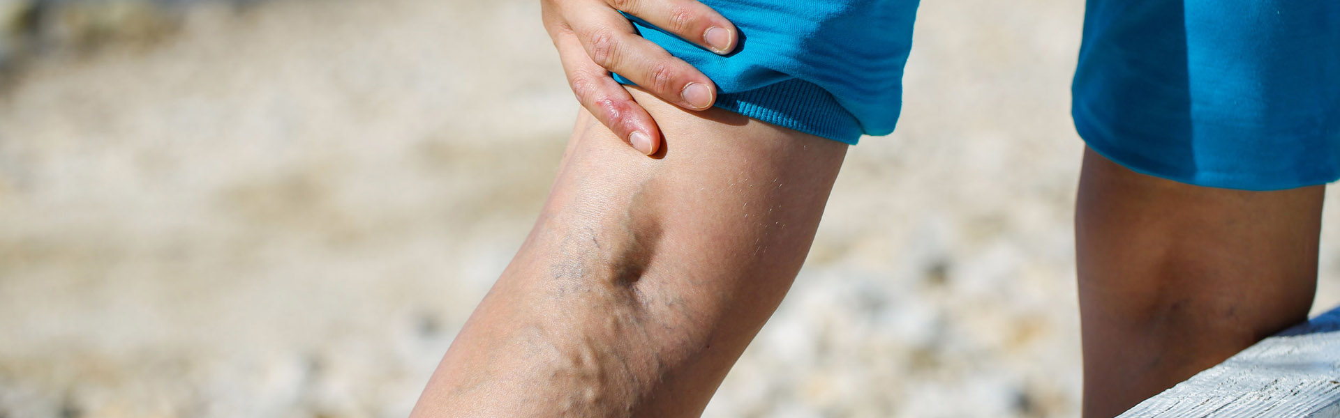 Gyors, hatékony és biztonságos visszérkezelés